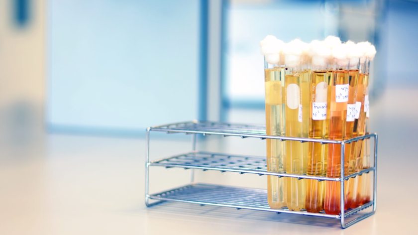 Test Tubes With Colorful Liquid In A Metal Rack On A Lab Counter At Auburn University At Montgomery.